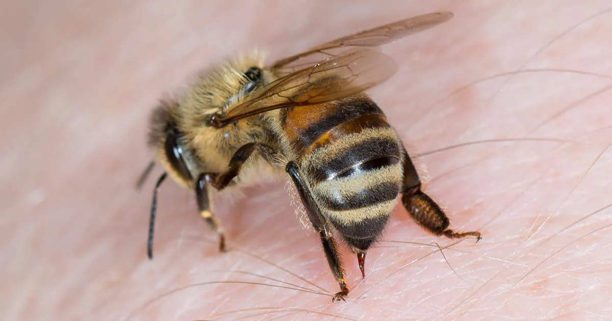 21161 allergy testing